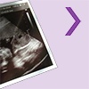 ultrahang terhesség hétről hétre