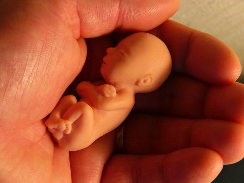abortusz