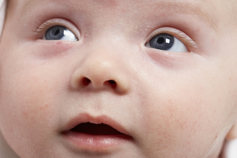 Ekcéma csecsemőkorban: hogyan kezdjük a hozzátáplálást?