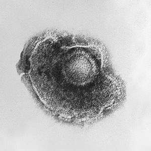 bárányhimlő varicella vírus